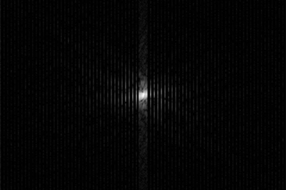 k-Raum-Daten einer MRT-Aufnahme