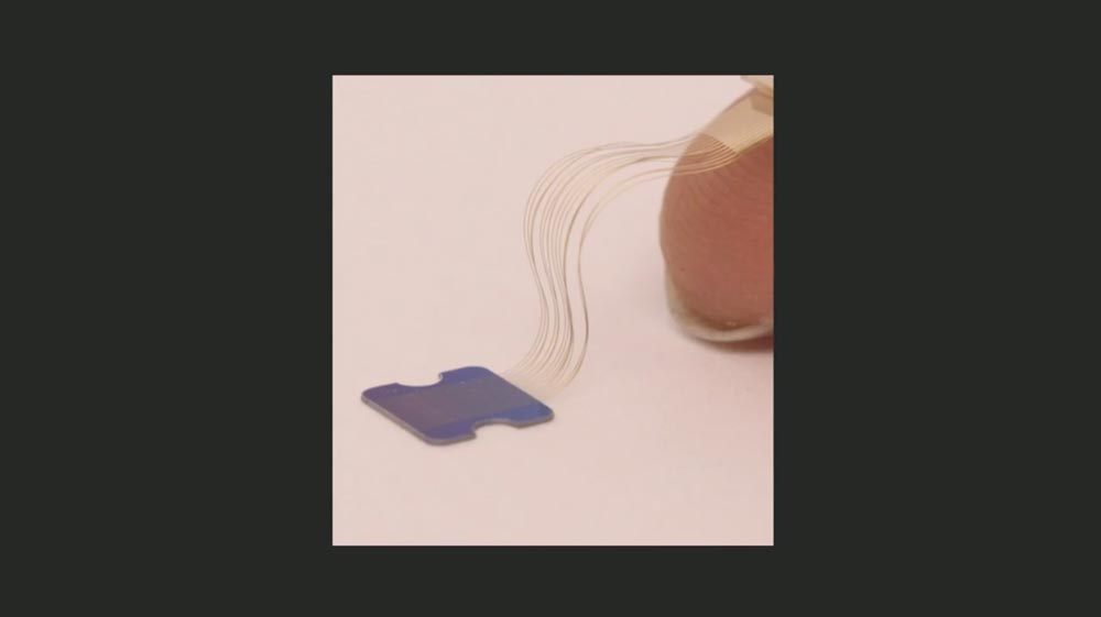 Neuralinks Spezialfasern für die Gehirndatenübertragung. Bild: Neuralink