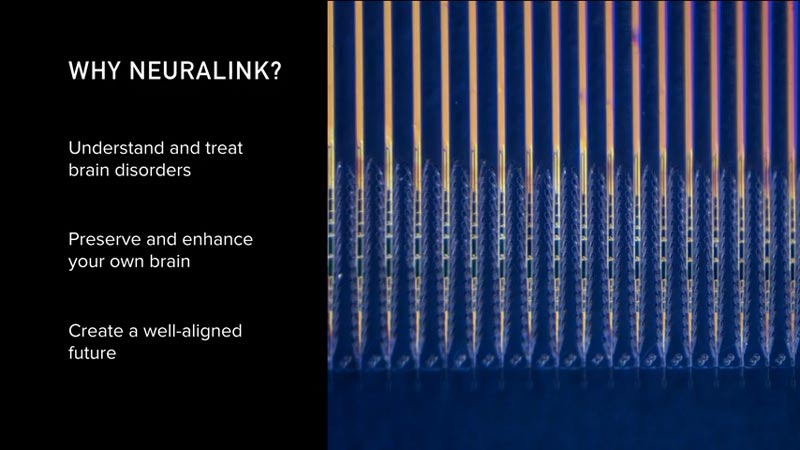 Weshalb Neuralink existiert. Bild: Neuralink